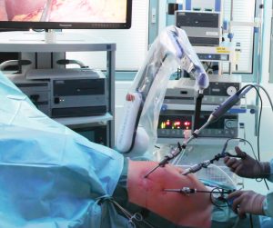 Der Roboterarm Soloassist II von AktorMed im Einsatz: Mithilfe von Sprachsteuerung wird die OP-Kamera vom Chirurgen an die richtige Stelle gefÃ¼hrt und liefert ihm ein perfektes Stand. (Bild: Aaronn Electronic GmbH)